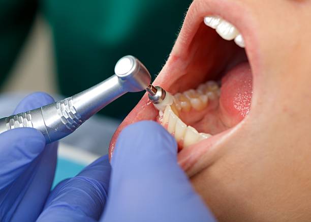 Oral Surgery in Eatonton, GA